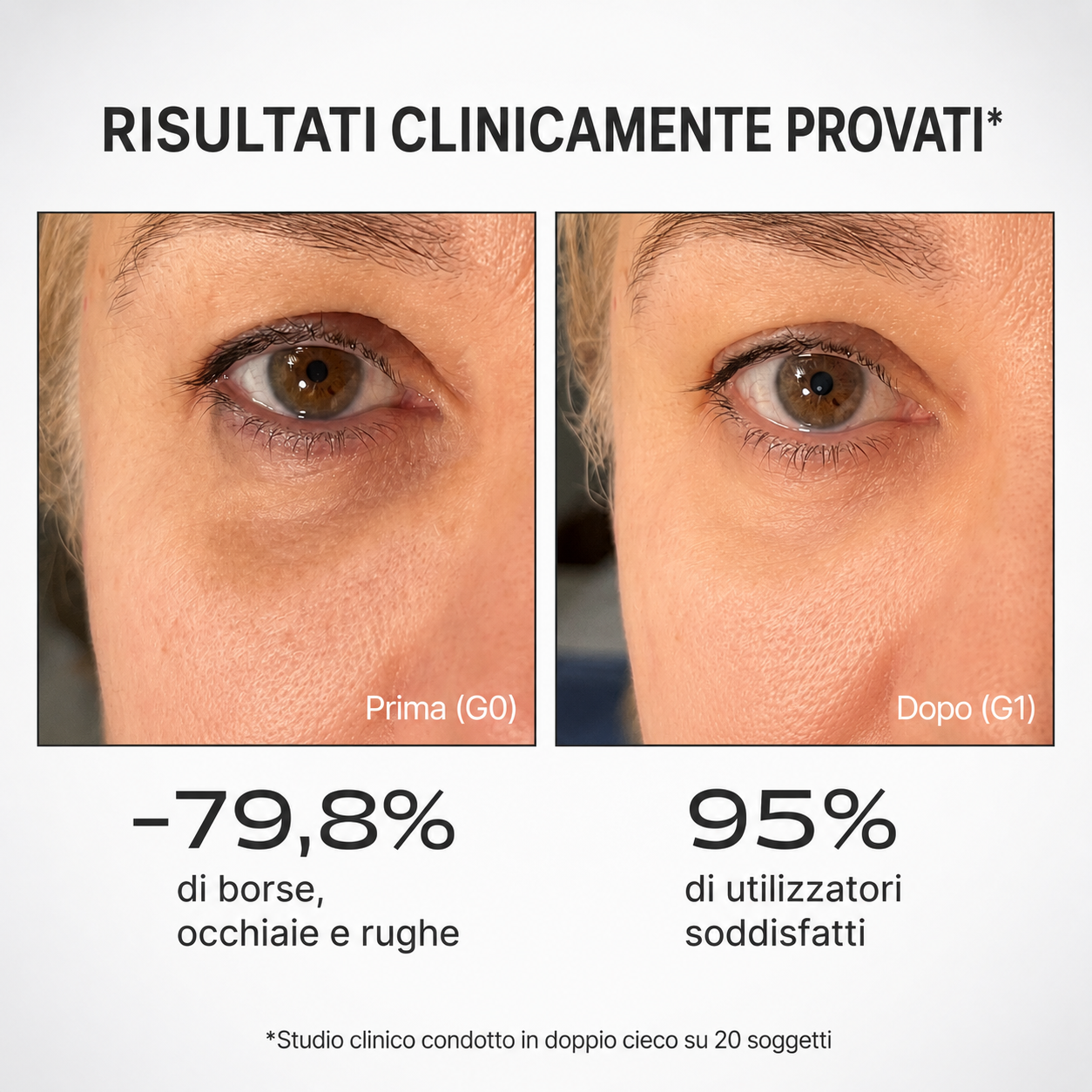 Odelle® Cerotti Occhi MicroInfusione