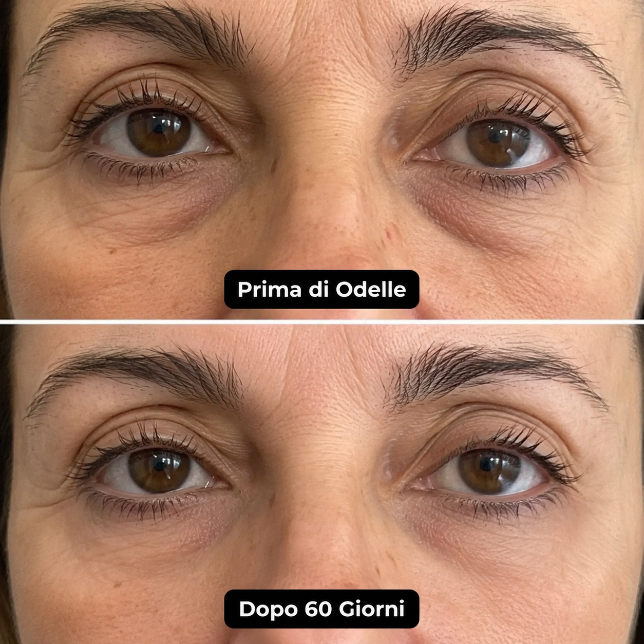 Odelle® Cerotti Occhi MicroInfusione