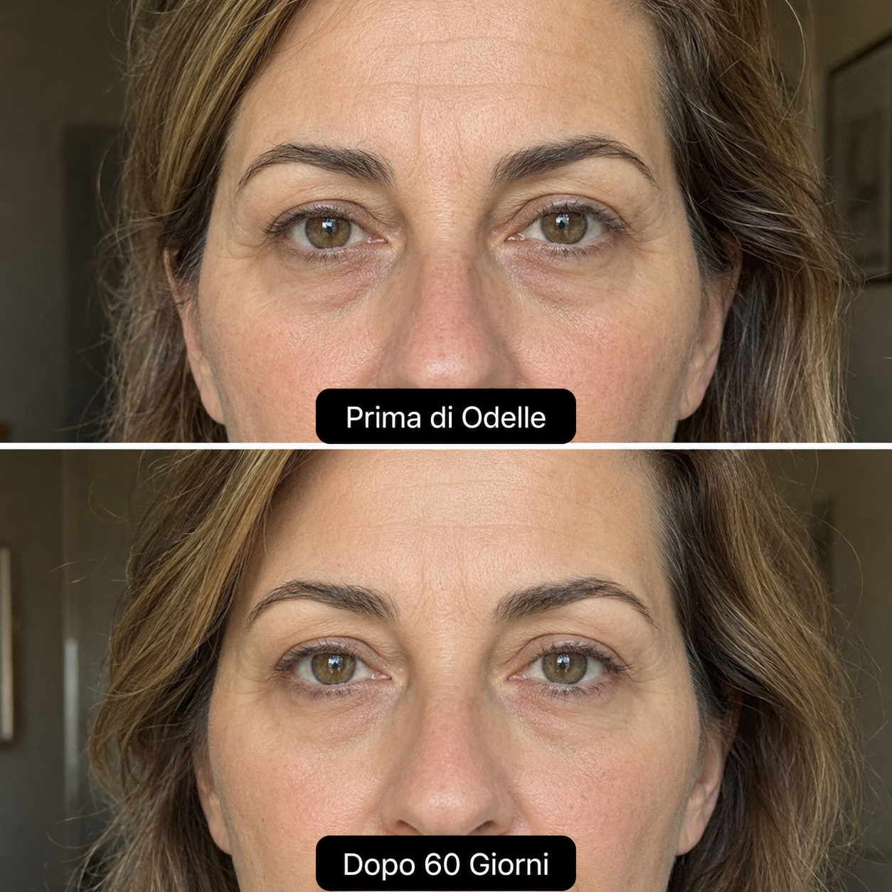 Odelle® Cerotti Occhi MicroInfusione
